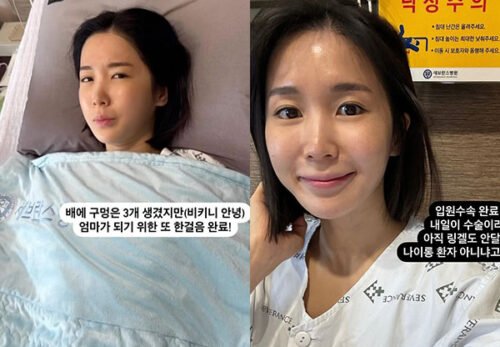 19choa eks crayon pop operasi kanker serviks Post